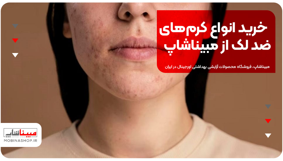 خرید انواع کرم‌های ضد لک از مبیناشاپ