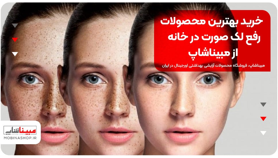 خرید بهترین محصولات رفع لک صورت در خانه از مبیناشاپ