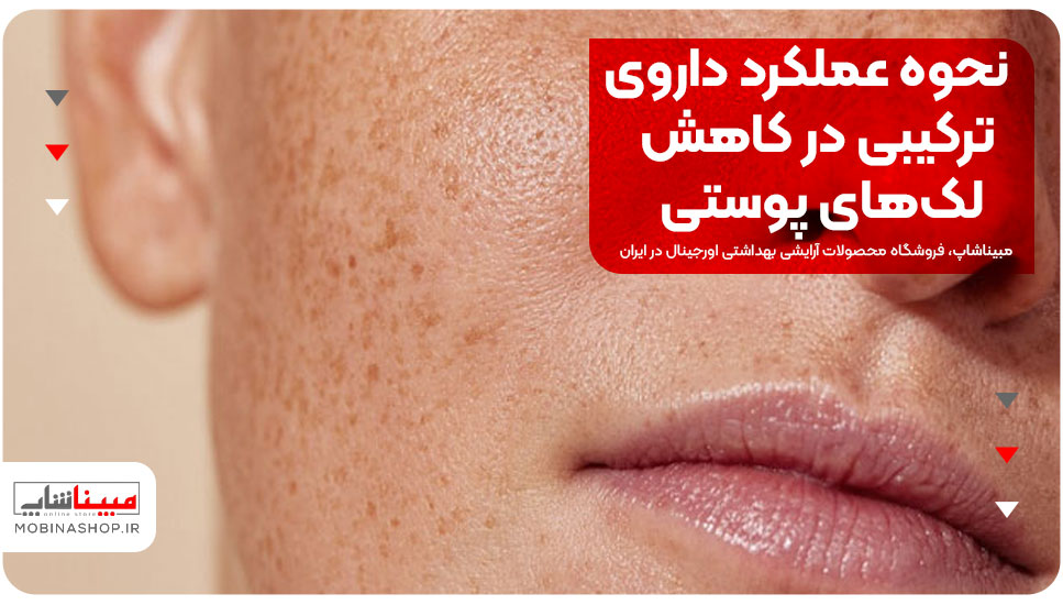 نحوه عملکرد داروی ترکیبی در کاهش لک‌های پوستی