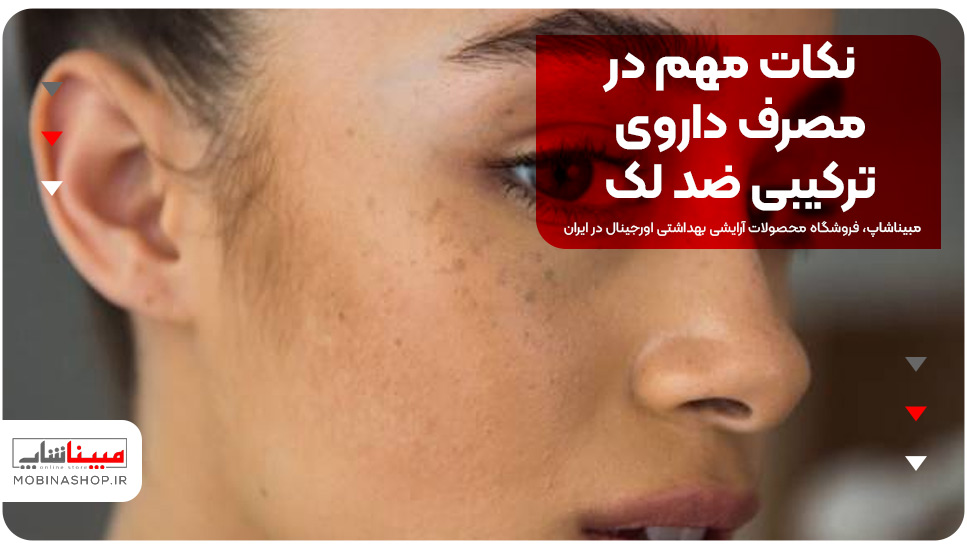  نکات مهم در مصرف داروی ترکیبی ضد لک