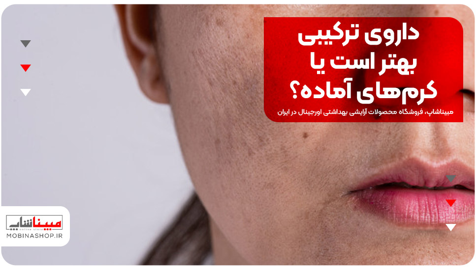 داروی ترکیبی بهتر است یا کرم‌های آماده؟ 
