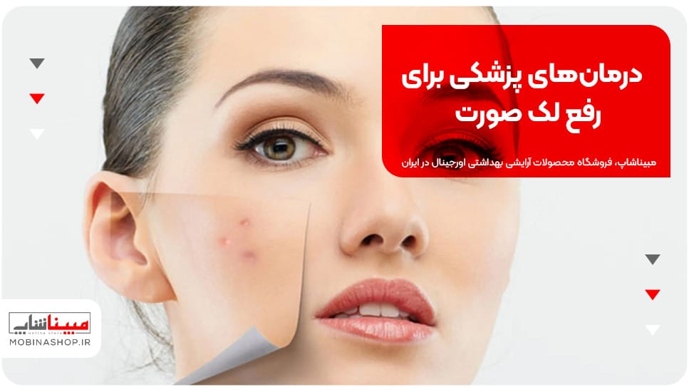 درمان‌های پزشکی برای رفع لک صورت