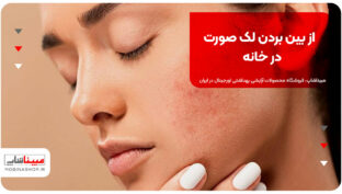 از بین بردن لک صورت در خانه