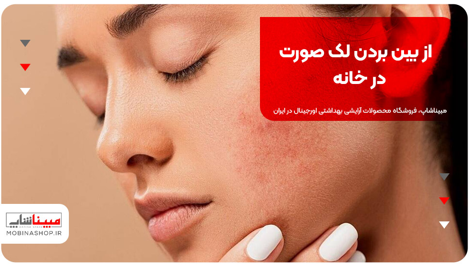 از بین بردن لک صورت در خانه