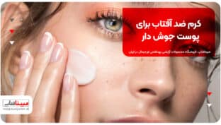 کرم ضد آفتاب برای پوست جوش دار