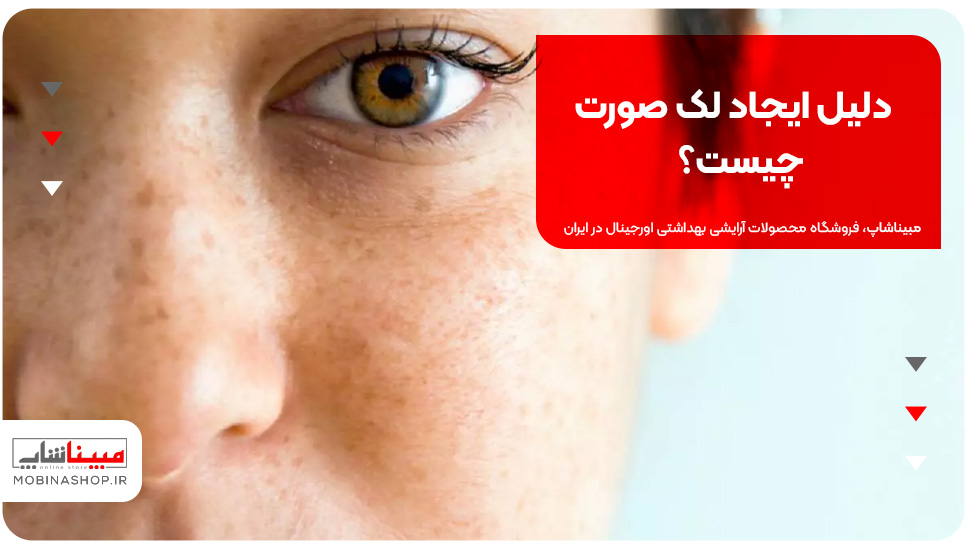 دلیل ایجاد لک صورت چیست؟